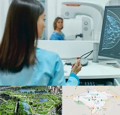 ماموگرافی در بجنورد