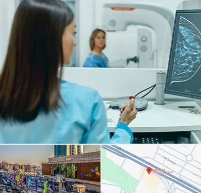 ماموگرافی در لاله پارک تبریز