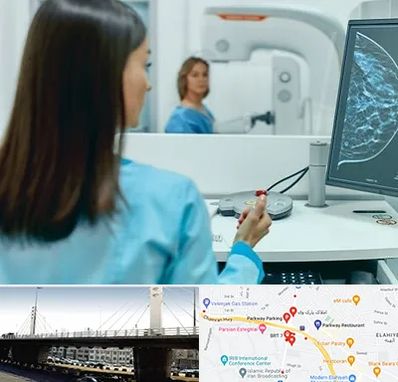 ماموگرافی در پارک وی 