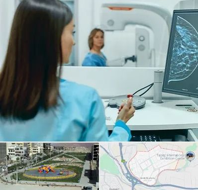 ماموگرافی در مرزداران تبریز