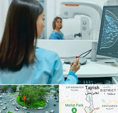 ماموگرافی در تجریش 