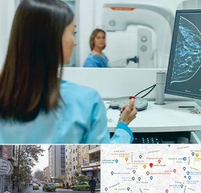 ماموگرافی در فاطمی