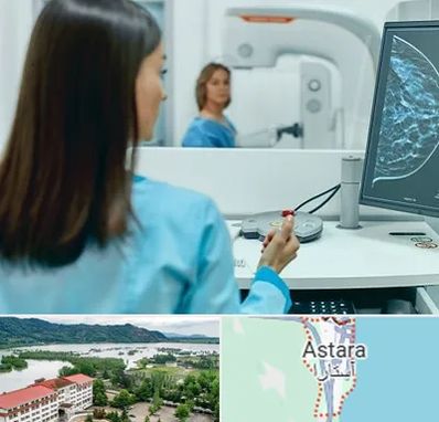 ماموگرافی در آستارا