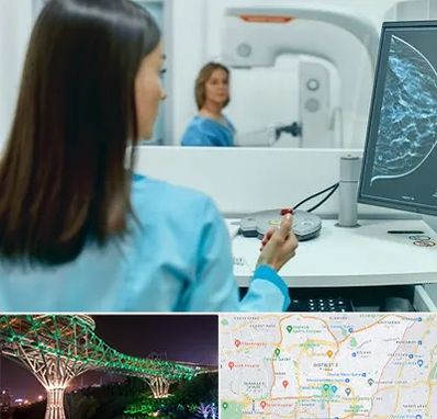 ماموگرافی در منطقه 3 تهران