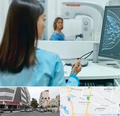 ماموگرافی در بلوار فردوس 