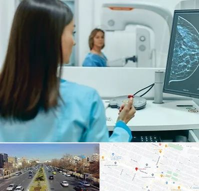 ماموگرافی در بلوار معلم مشهد