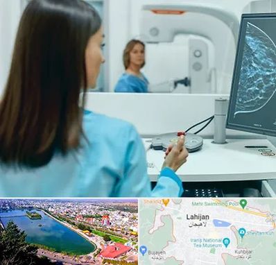 ماموگرافی در لاهیجان