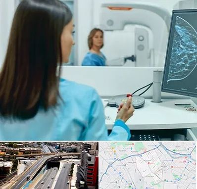 ماموگرافی در ستارخان شیراز