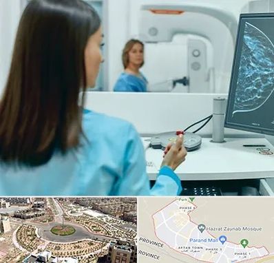 ماموگرافی در پرند