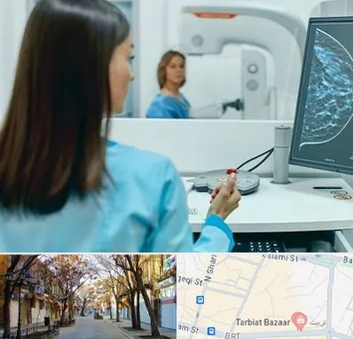 ماموگرافی در تربیت تبریز