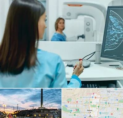 ماموگرافی در منطقه 2 تهران