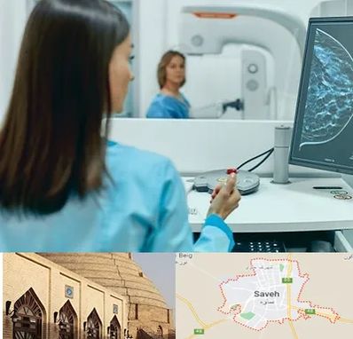 ماموگرافی در ساوه