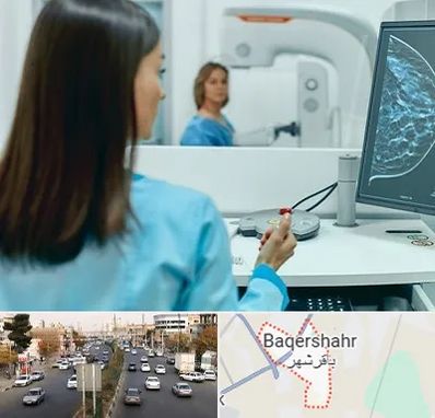 ماموگرافی در باقرشهر