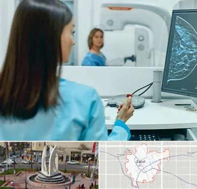 ماموگرافی در زابل