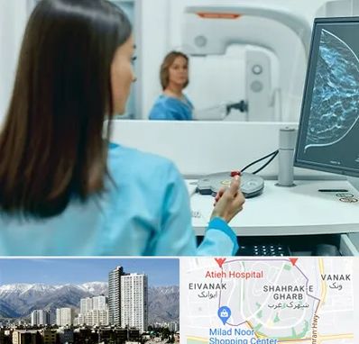 ماموگرافی در شهرک غرب 