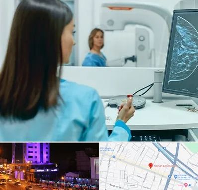 ماموگرافی در آبرسان تبریز