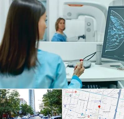 ماموگرافی در امامت مشهد