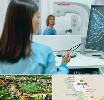 ماموگرافی در بروجرد