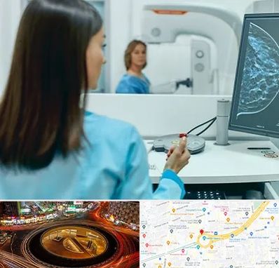 ماموگرافی در میدان ولیعصر