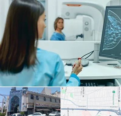 ماموگرافی در بلوار ابوذر