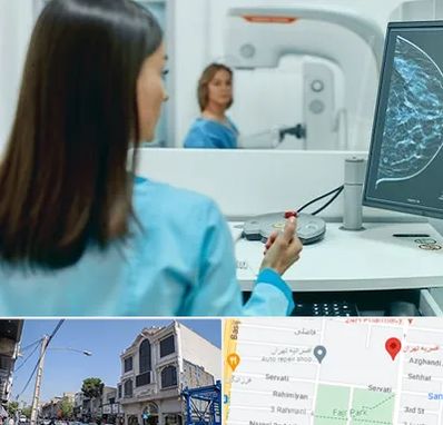 ماموگرافی در افسریه 