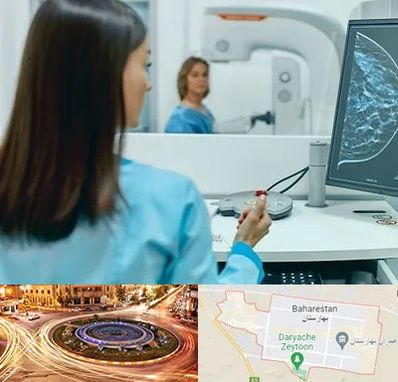 ماموگرافی در بهارستان