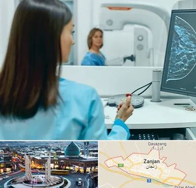 ماموگرافی در زنجان