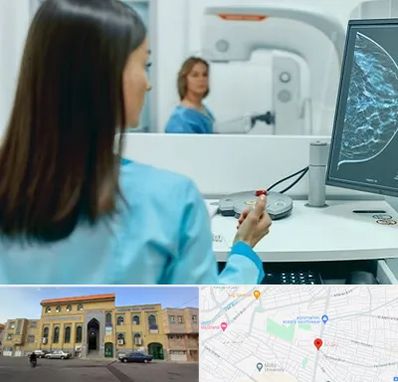 ماموگرافی در زنبیل آباد قم