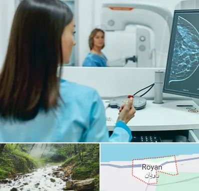 ماموگرافی در رویان