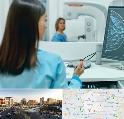 ماموگرافی در منطقه 7 تهران