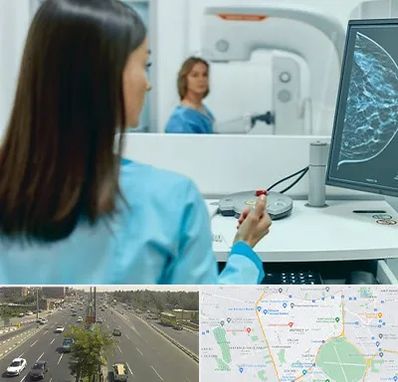 ماموگرافی در منطقه 17 تهران