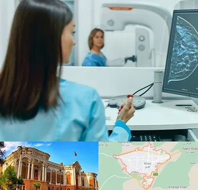 ماموگرافی در خوی