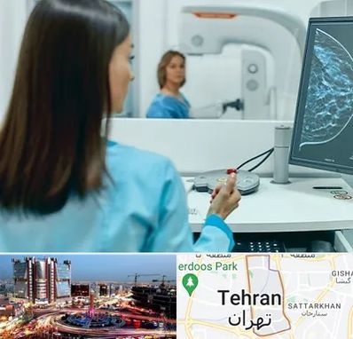 ماموگرافی در صادقیه 