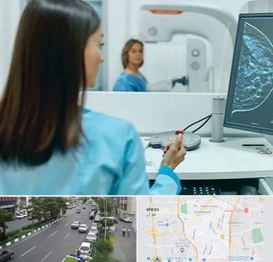 ماموگرافی در ستارخان 