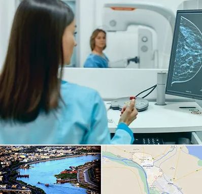 ماموگرافی در خرمشهر