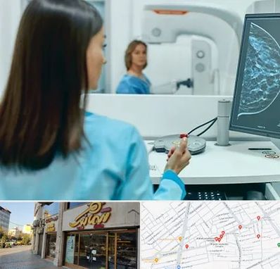 ماموگرافی در عطاران قم