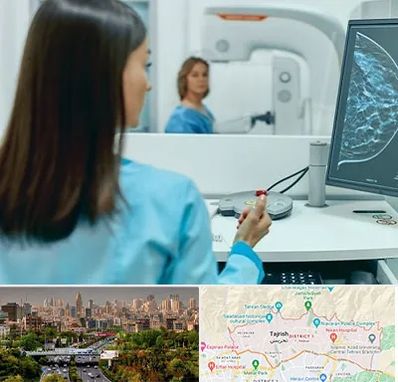 ماموگرافی در منطقه 1 تهران