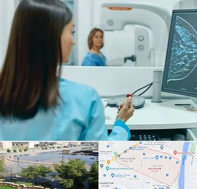 ماموگرافی در گلستان اهواز