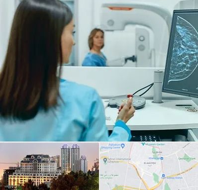 ماموگرافی در فرشته 