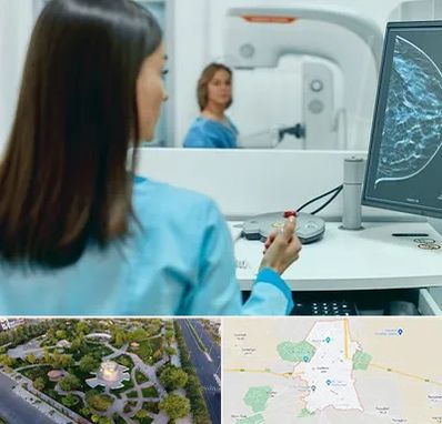 ماموگرافی در کاشمر