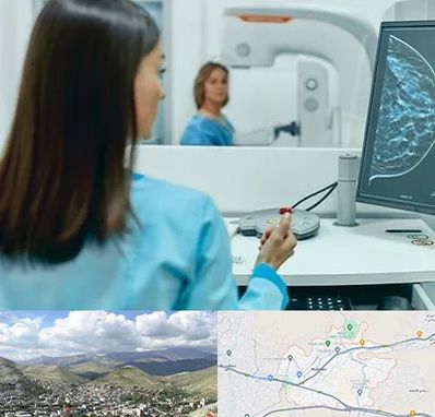 ماموگرافی در رودهن