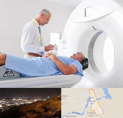 سی تی اسکن در میناب