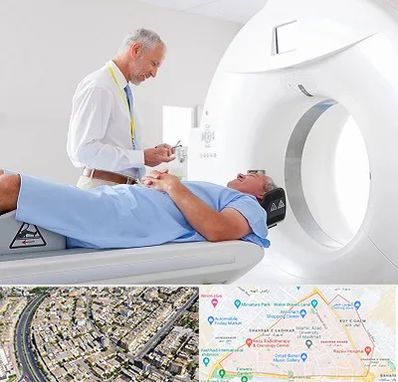 سی تی اسکن در شهرک غرب مشهد