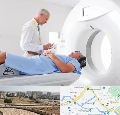 سی تی اسکن در کوی وحدت شیراز