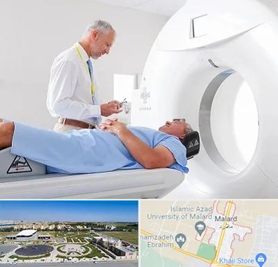 سی تی اسکن در ملارد