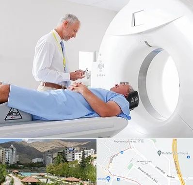 سی تی اسکن در شهر زیبا