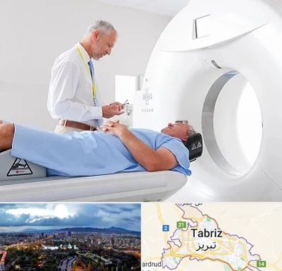 سی تی اسکن در تبریز