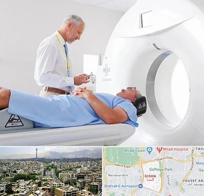 سی تی اسکن در گیشا 