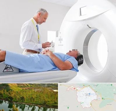 سی تی اسکن در بهبهان