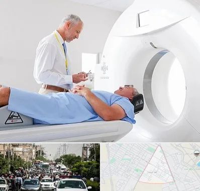 سی تی اسکن در سیدی مشهد